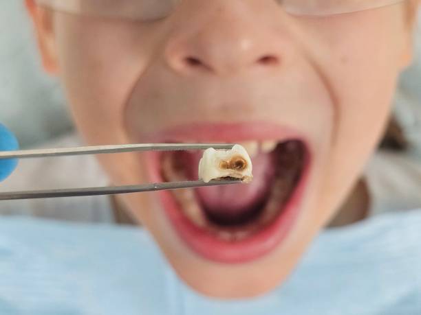 Best Emergency Orthodontic Repairs in Bloomingdale, GA